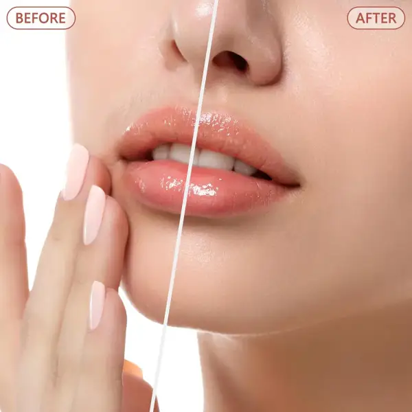 جهاز إزالة شعر الوجه  -face hair remover